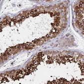 Anti-BCAP29 antibody produced in rabbit Prestige Antibodies® Powered by Atlas Antibodies, affinity isolated antibody, buffered aqueous glycerol solution