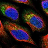 Anti-PNPLA8 antibody produced in rabbit Prestige Antibodies® Powered by Atlas Antibodies, affinity isolated antibody, buffered aqueous glycerol solution