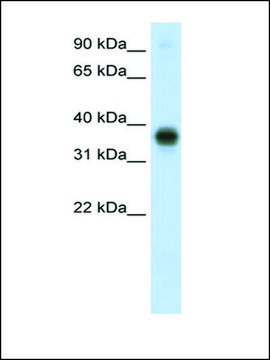 Anti-E2F3 antibody produced in rabbit affinity isolated antibody