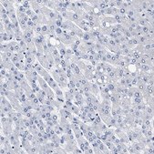 Anti-KLHL41 antibody produced in rabbit Prestige Antibodies® Powered by Atlas Antibodies, affinity isolated antibody, buffered aqueous glycerol solution, Ab3
