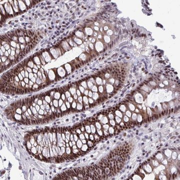 Anti-FIBCD1 antibody produced in rabbit Prestige Antibodies&#174; Powered by Atlas Antibodies, affinity isolated antibody, buffered aqueous glycerol solution