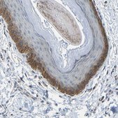 Anti-SLC43A1 antibody produced in rabbit Prestige Antibodies® Powered by Atlas Antibodies, affinity isolated antibody, buffered aqueous glycerol solution
