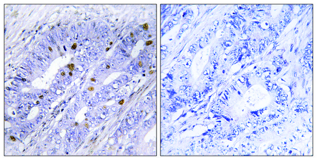 Anti-Nuclear Receptor NR4A1 antibody produced in rabbit affinity isolated antibody