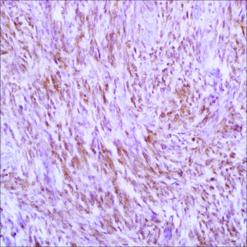 CITED1 (5H6) Mouse Monoclonal Antibody