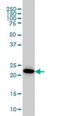 Monoclonal Anti-AK1 antibody produced in mouse clone M1, purified immunoglobulin, buffered aqueous solution