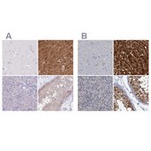 Anti-FAH antibody produced in rabbit Prestige Antibodies® Powered by Atlas Antibodies, affinity isolated antibody, buffered aqueous glycerol solution
