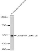 Anti-Cytokeratin 16 (KRT16) Antibody, clone 8L6R4, Rabbit Monoclonal