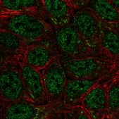 Anti-SEMA4A antibody produced in rabbit Prestige Antibodies® Powered by Atlas Antibodies, affinity isolated antibody, buffered aqueous glycerol solution