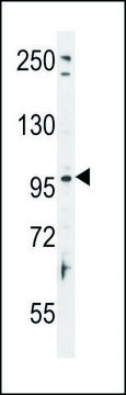 ANTI-TAS1R2 (C-TERM) antibody produced in rabbit IgG fraction of antiserum, buffered aqueous solution