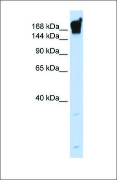 Anti-DYSF (ab1) antibody produced in rabbit affinity isolated antibody