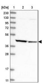 Anti-ACY1 antibody produced in rabbit Prestige Antibodies® Powered by Atlas Antibodies, affinity isolated antibody, buffered aqueous glycerol solution