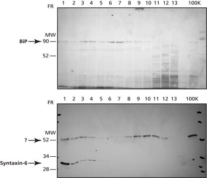 Endoplasmic Reticulum Isolation Kit isolation of intact ER from mammalian soft tissues and cultured cells