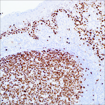 Ki-67 (SP6) Rabbit Monoclonal Antibody