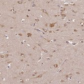 Anti-BRAP antibody produced in rabbit Prestige Antibodies® Powered by Atlas Antibodies, affinity isolated antibody, buffered aqueous glycerol solution