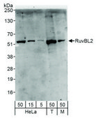 Rabbit anti-RuvBL2 Antibody, Affinity Purified Powered by Bethyl Laboratories, Inc.