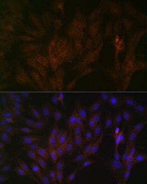 Anti-15-PGDH/HPGD Antibody, clone 2X4N7, Rabbit Monoclonal