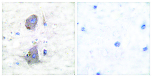 Anti-GLUT1 antibody produced in rabbit affinity isolated antibody