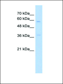 Anti-ITGBL1 (AB2) antibody produced in rabbit IgG fraction of antiserum