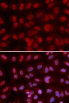 Anti-SIN3A antibody produced in rabbit