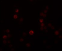 Anti-PLAC4 antibody produced in rabbit affinity isolated antibody, buffered aqueous solution