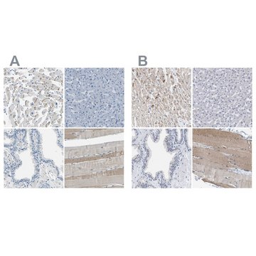 Anti-XIRP1 antibody produced in rabbit Prestige Antibodies® Powered by Atlas Antibodies, affinity isolated antibody, buffered aqueous glycerol solution, Ab2