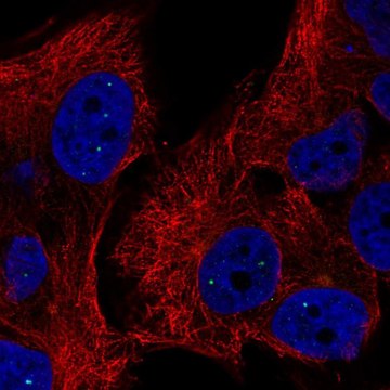 Anti-TYW5 antibody produced in rabbit Prestige Antibodies&#174; Powered by Atlas Antibodies, affinity isolated antibody