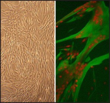 Human Skeletal Muscle Cells: HSkMC, adult