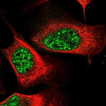 Anti-EEPD1 antibody produced in rabbit Prestige Antibodies&#174; Powered by Atlas Antibodies, affinity isolated antibody