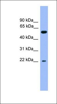 Anti-COCH antibody produced in rabbit affinity isolated antibody