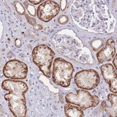 Anti-SLC25A42 antibody produced in rabbit Prestige Antibodies® Powered by Atlas Antibodies, affinity isolated antibody, buffered aqueous glycerol solution