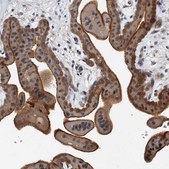 Anti-CD200 antibody produced in rabbit Prestige Antibodies® Powered by Atlas Antibodies, affinity isolated antibody, buffered aqueous glycerol solution