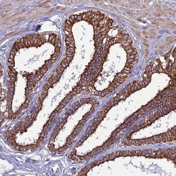 Anti-LZTS2 antibody produced in rabbit Prestige Antibodies&#174; Powered by Atlas Antibodies, affinity isolated antibody, buffered aqueous glycerol solution