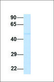 Anti-TP73 antibody produced in rabbit affinity isolated antibody