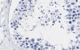 Anti-ATR Antibody, clone 1B15 ZooMAb® Rabbit Monoclonal recombinant, expressed in HEK 293 cells