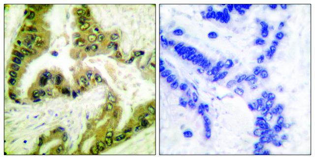 Anti-HDAC10 antibody produced in rabbit affinity isolated antibody