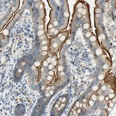 Anti-NPDC1 antibody produced in rabbit Prestige Antibodies® Powered by Atlas Antibodies, affinity isolated antibody, buffered aqueous glycerol solution