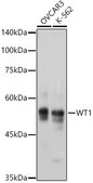 Anti-WT1 Antibody, clone 6L9X6, Rabbit Monoclonal