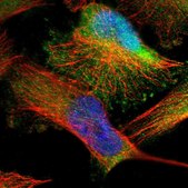 Anti-DENND4C antibody produced in rabbit Prestige Antibodies® Powered by Atlas Antibodies, affinity isolated antibody, buffered aqueous glycerol solution