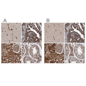 Anti-KIAA0753 antibody produced in rabbit Prestige Antibodies&#174; Powered by Atlas Antibodies, affinity isolated antibody, buffered aqueous glycerol solution, Ab1