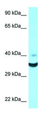 Anti-NCR1 (N-terminal) antibody produced in rabbit affinity isolated antibody