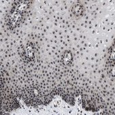 Anti-NOP58 antibody produced in rabbit Prestige Antibodies® Powered by Atlas Antibodies, affinity isolated antibody, buffered aqueous glycerol solution