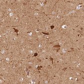 Anti-CRYM antibody produced in rabbit Prestige Antibodies® Powered by Atlas Antibodies, affinity isolated antibody