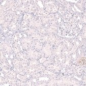 Monoclonal Anti-Lag3 Antibody Produced In Mouse Prestige Antibodies® Powered by Atlas Antibodies, clone CL14773, affinity isolated antibody, buffered aqueous glycerol solution