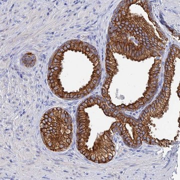 Anti-SRFBP1 antibody produced in rabbit Prestige Antibodies&#174; Powered by Atlas Antibodies, affinity isolated antibody, buffered aqueous glycerol solution