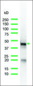 Anti-Keratin 17 antibody, Rabbit monoclonal clone SP95, recombinant, expressed in proprietary host, affinity isolated antibody