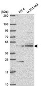 Anti-ETNPPL antibody produced in rabbit Prestige Antibodies® Powered by Atlas Antibodies, affinity isolated antibody
