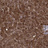 Anti-QPRT antibody produced in rabbit Prestige Antibodies® Powered by Atlas Antibodies, affinity isolated antibody, buffered aqueous glycerol solution