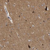 Anti-GDAP1 antibody produced in rabbit Prestige Antibodies® Powered by Atlas Antibodies, affinity isolated antibody, buffered aqueous glycerol solution