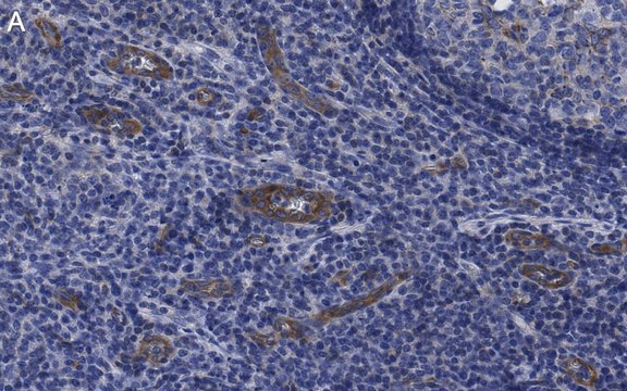 Anti-VCAM-1 Antibody, clone 5K19 ZooMAb&#174; Rabbit Monoclonal recombinant, expressed in HEK 293 cells