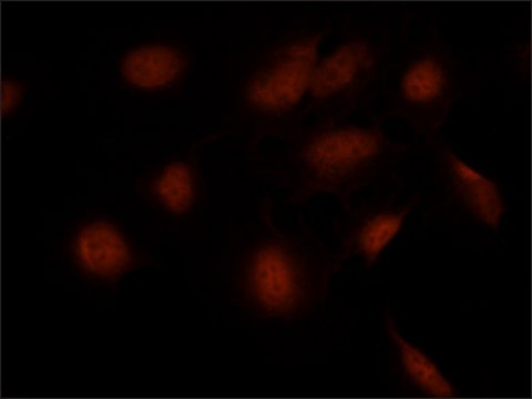 Anti-SMAD7 (N-terminal) antibody produced in rabbit ~1.0&#160;mg/mL, affinity isolated antibody, suitable for western blot: 2&#160;&#956;g/mL